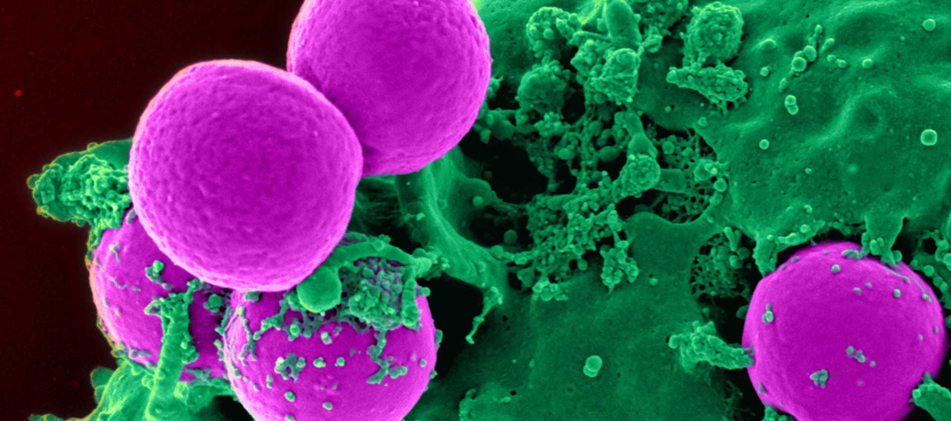 How-To-Reduce-The-Risk-Of-MRSA-with-Airius-PureAir