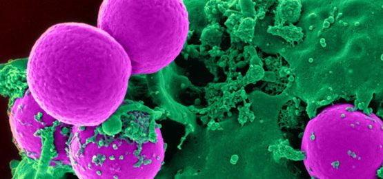 How-To-Reduce-The-Risk-Of-MRSA-with-Airius-PureAir-Button